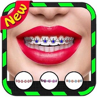 Braces Booth Selfie Camera Photo Collage FREE 3D