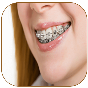 Braces Photo Editor - Braces For Your Teeth