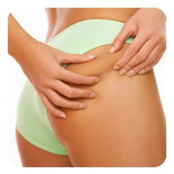 cellulite treatment at home
