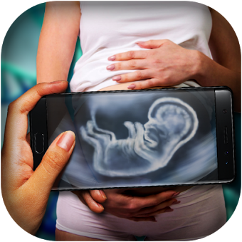 Xray Scanner Pregnant Prank New